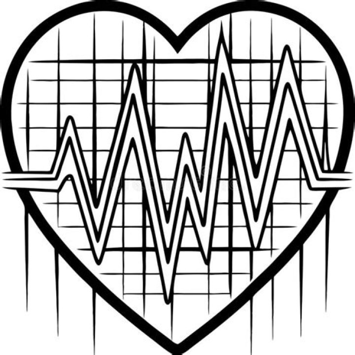 A line graph displays heart rate data from three different wearables, including the Garmin device, a chest strap, and a Fitbit Versa 3.