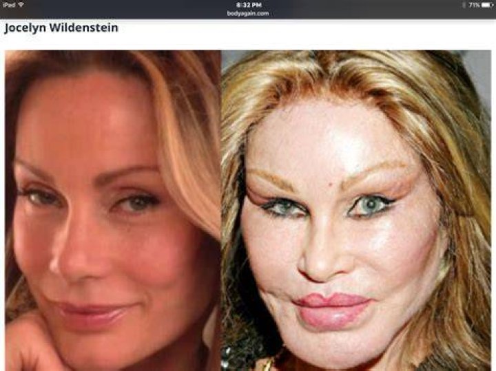 celebrity plastic surgery celebrity plastic surgery