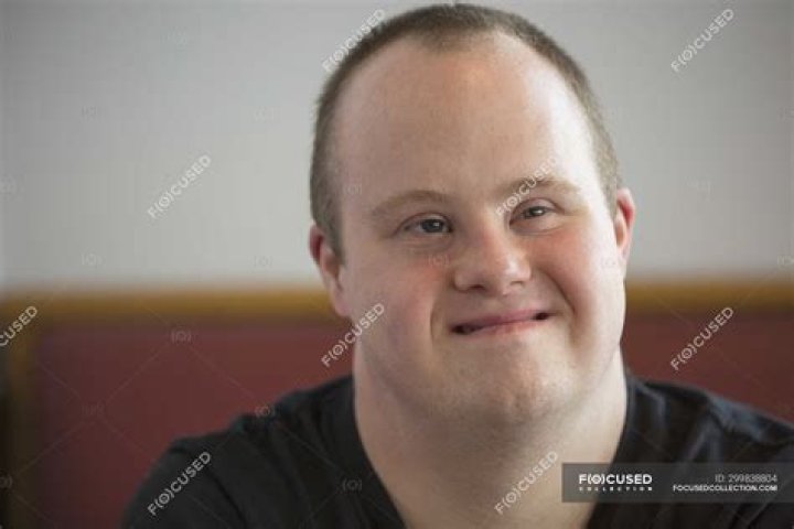 Down Syndrome