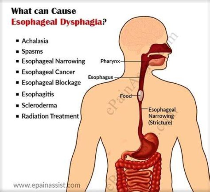 How Anxiety Causes Esophagus Problems