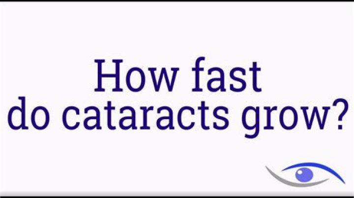 How Fast Do Cataracts Grow