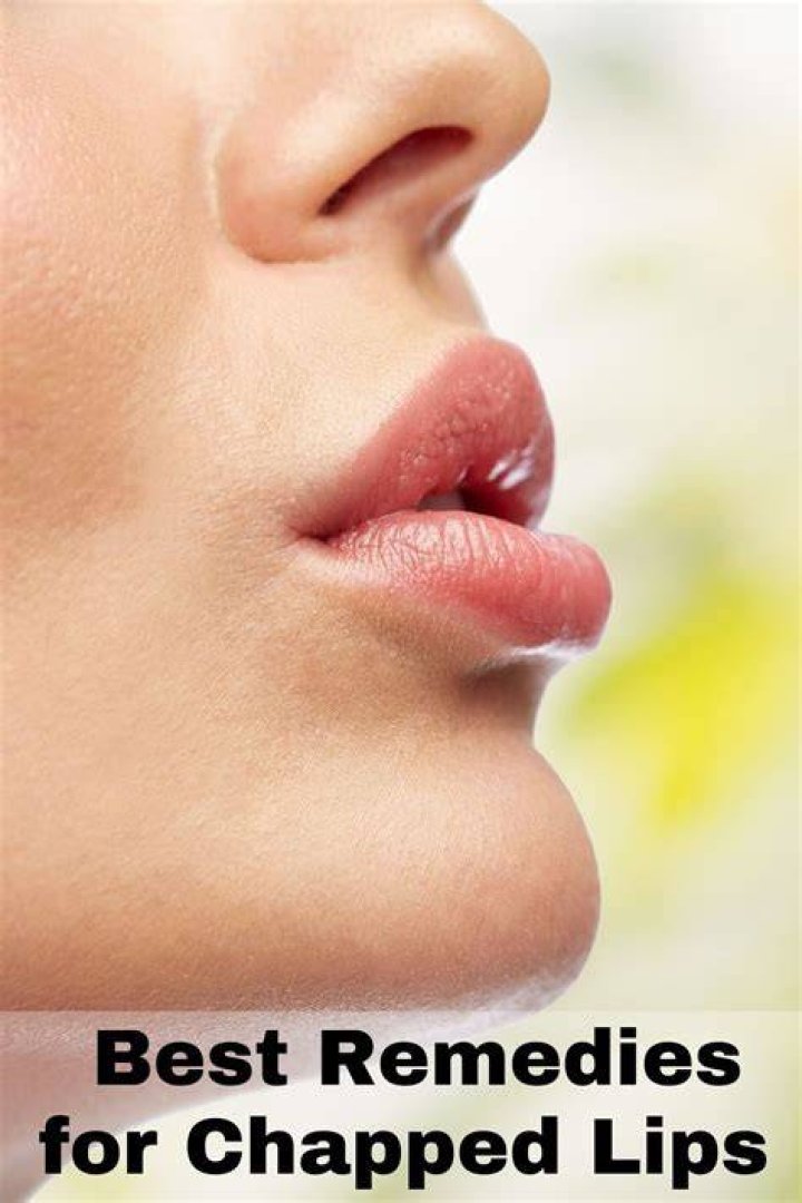 How to Fix Severe Chapped Lips Overnight