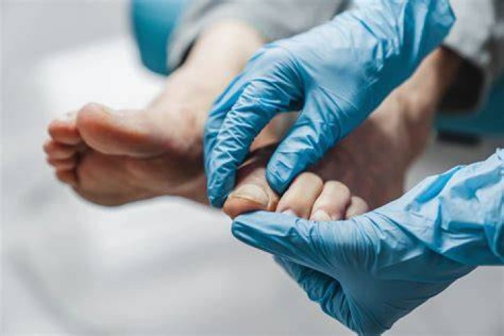 Is Surgery Needed for Treating Rare Foot Conditions?