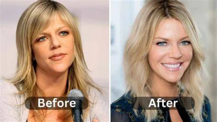Kaitlin Olson Plastic Surgery Kaitlin Olson Plastic Surgery