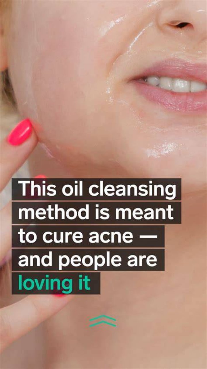 oil cleansing method acne cure