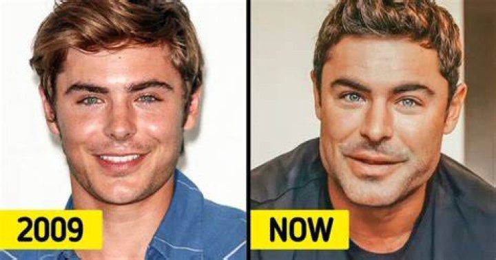 Zac Efron Face